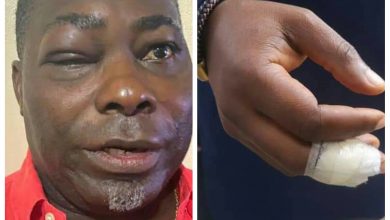 Photo of PHOTOS: Charles Bissue’s face disfigured after trading blows with Tarkwa-Nsuaem MP