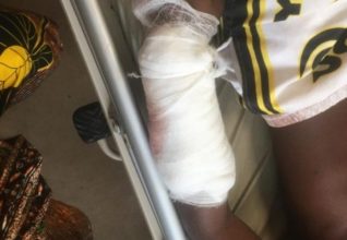 Photo of SHS student battles for his life after assault over ¢5 debt