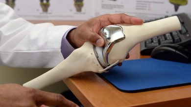 Photo of Scientists develop 3D-printed artificial knee