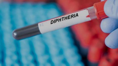 Photo of Nigeria confirms deadly diphtheria outbreak