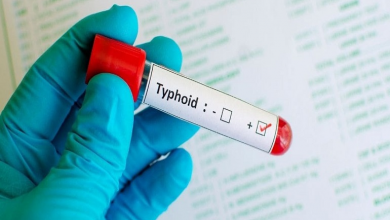 Photo of Prevalence Of Typhoid: Public Encouraged To Pursue Hygiene Habits