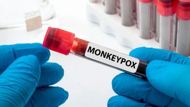 Photo of South Africa reports first death from monkey pox virus
